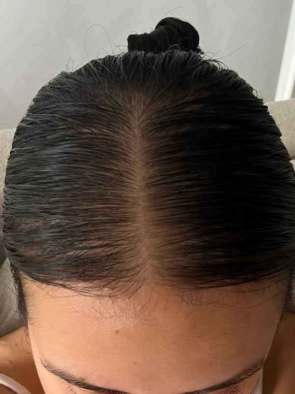 Anita A - 15 weeks after