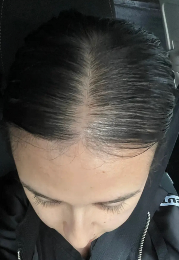 Anita A - 15 weeks before
