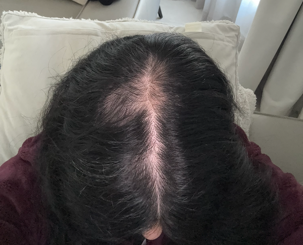 Ronya Gilani (Founder) - 6 Months after