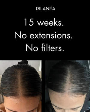 Cryo Glow HairVive™