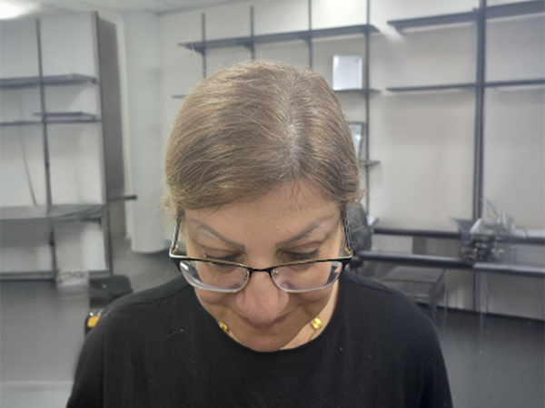 Maria N - 1 month after