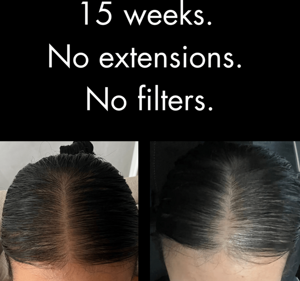 Cryo Glow HairVive™ - RILANÉA
